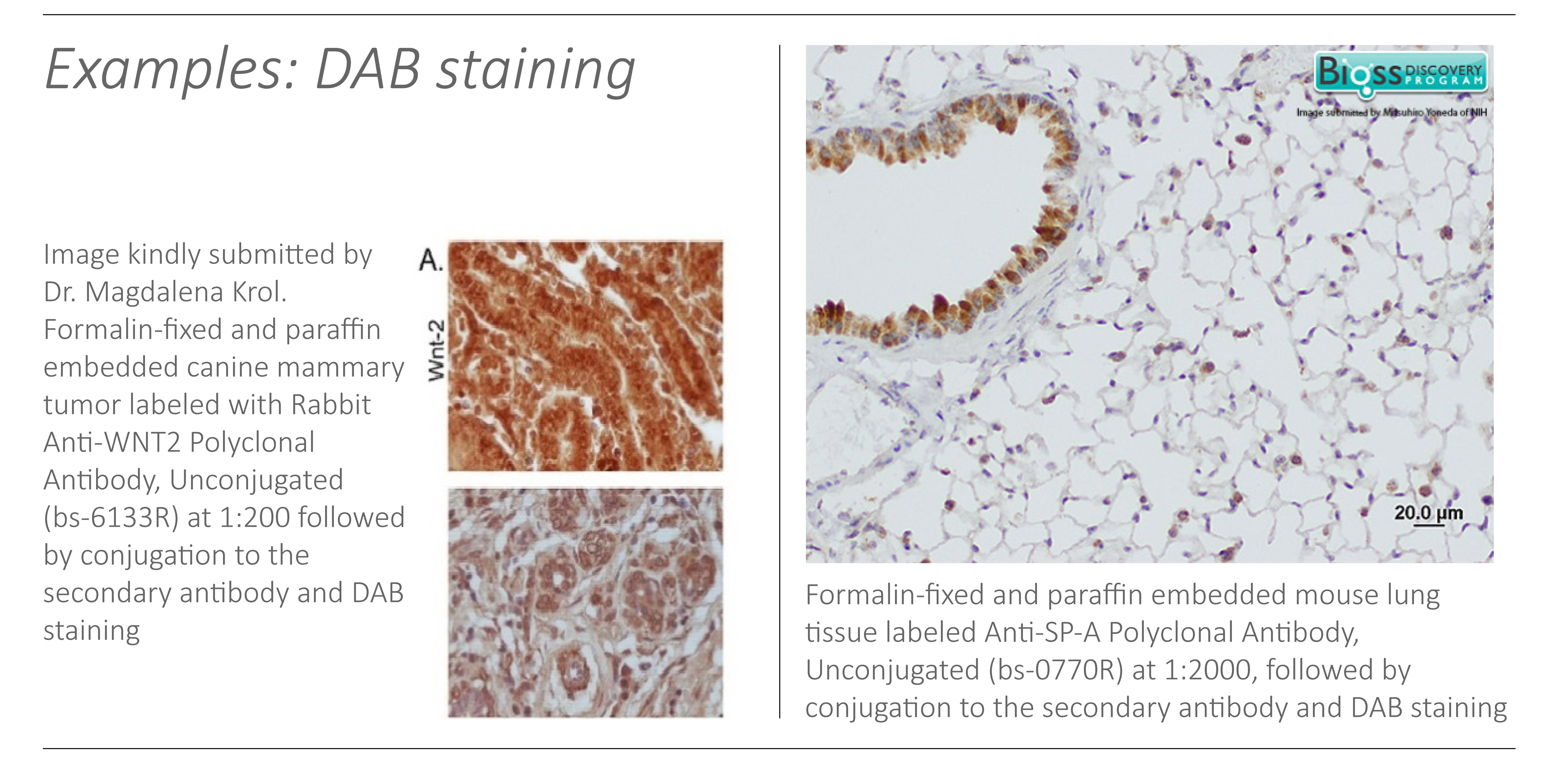 DAB staining examples